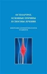 Остеоартроз. Основные причины и способы лечения