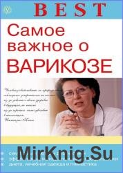 Самое важное о варикозе