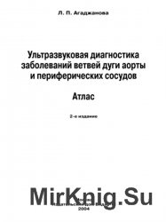 Ультразвуковая диагностика заболеваний ветвей дуги аорты и периферических сосудов. Атлас