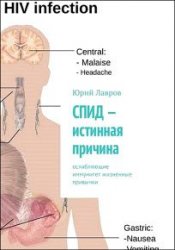 СПИД – истинная причина. Ослабляющие иммунитет жизненные привычки