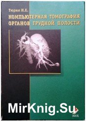 Компьютерная томография органов грудной полости