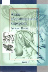 Атлас абдоминальной хирургии (Том 2)