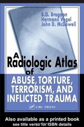 A Radiologic Atlas of Abuse, Torture, Terrorism, and Inflicted Trauma